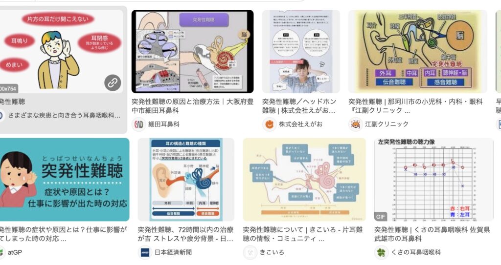 突発性難聴
