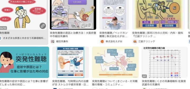 突発性難聴