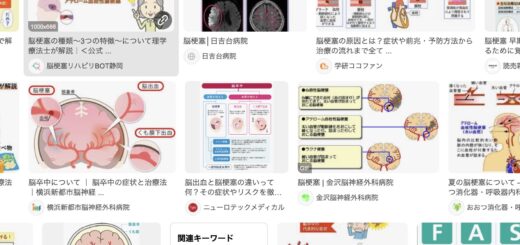 脳梗塞