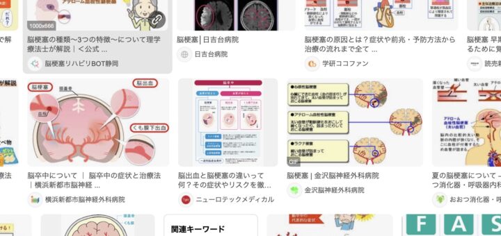 脳梗塞
